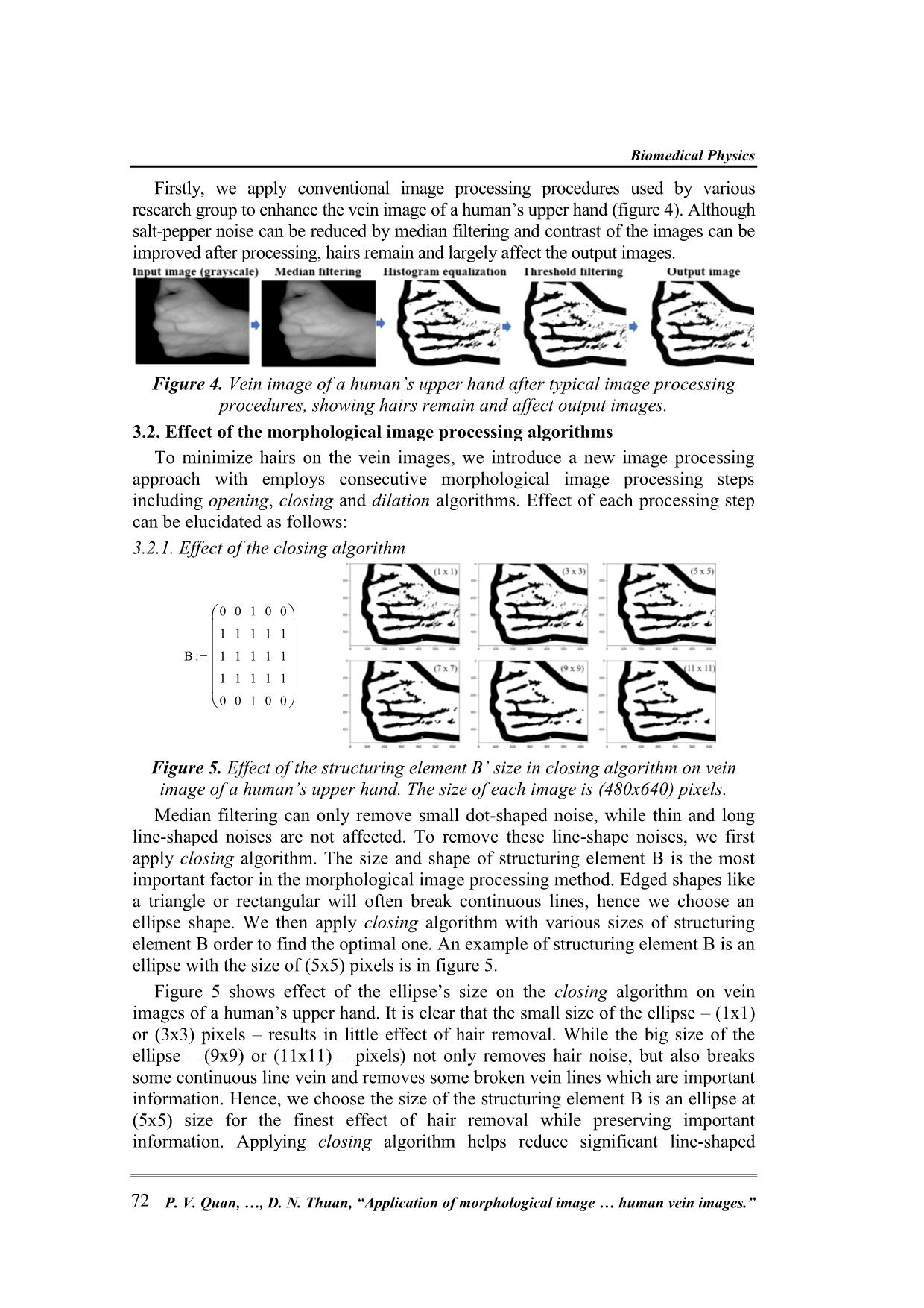 Application of morphological image processing to remove hair noises while enhancing patterns of near-Infrared human vein images trang 4