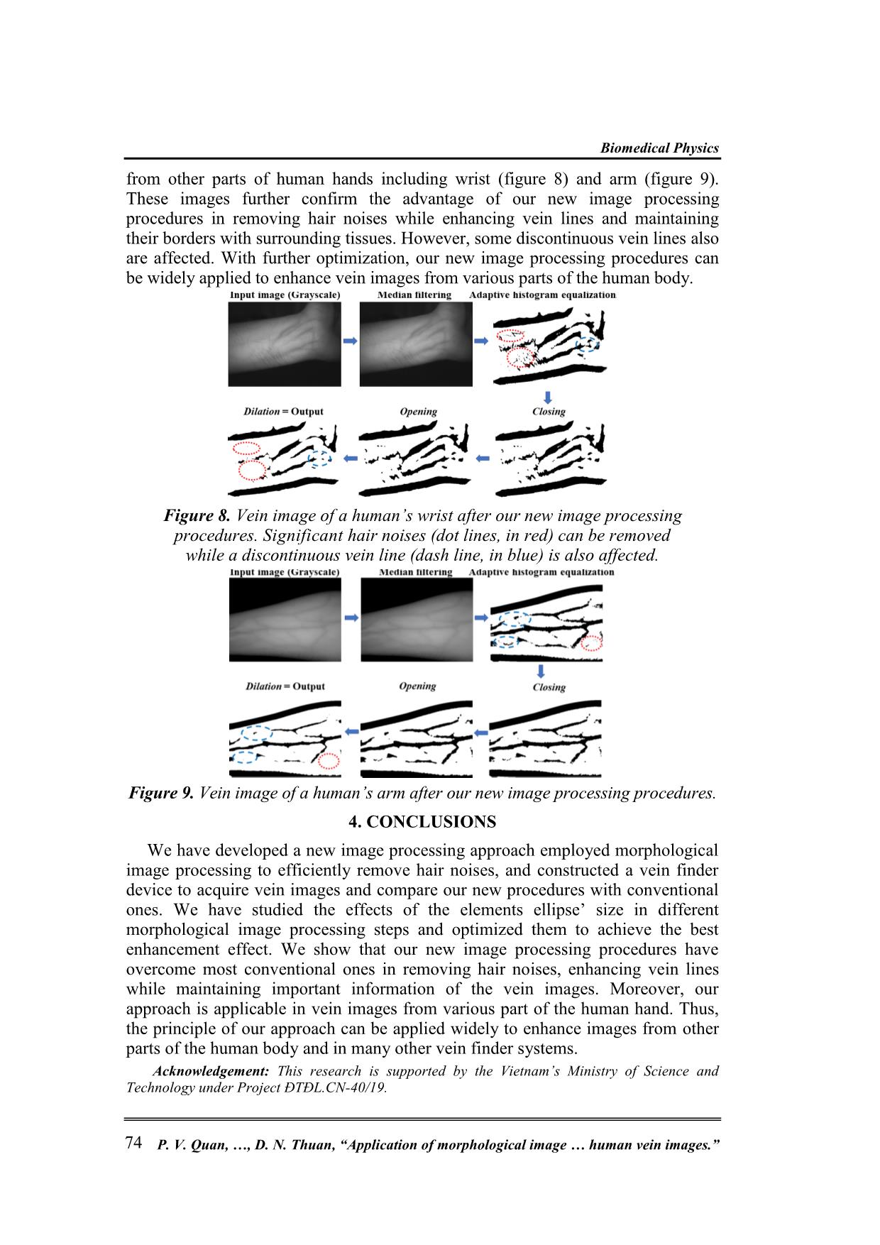 Application of morphological image processing to remove hair noises while enhancing patterns of near-Infrared human vein images trang 6