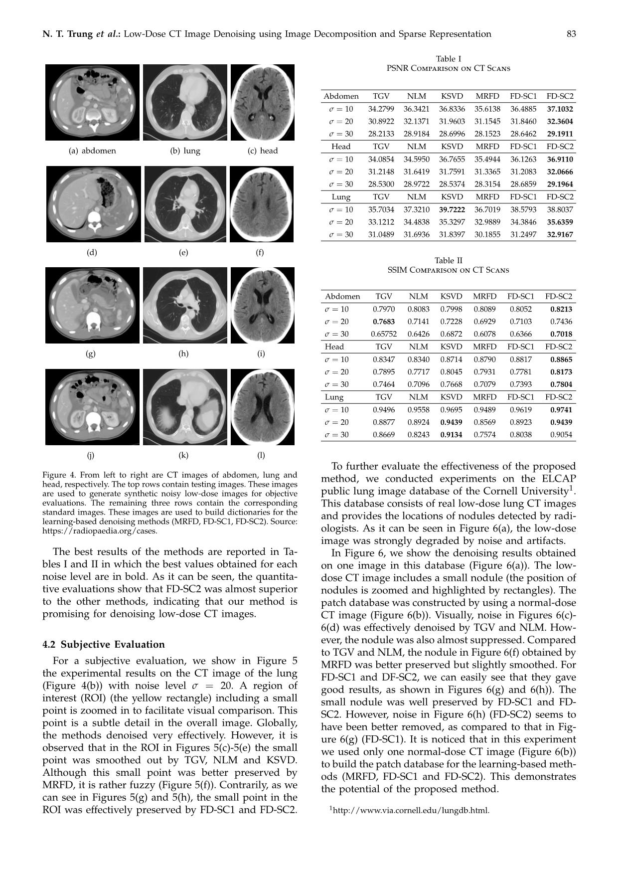 Low-Dose CT image denoising using image decomposition and sparse representation trang 6