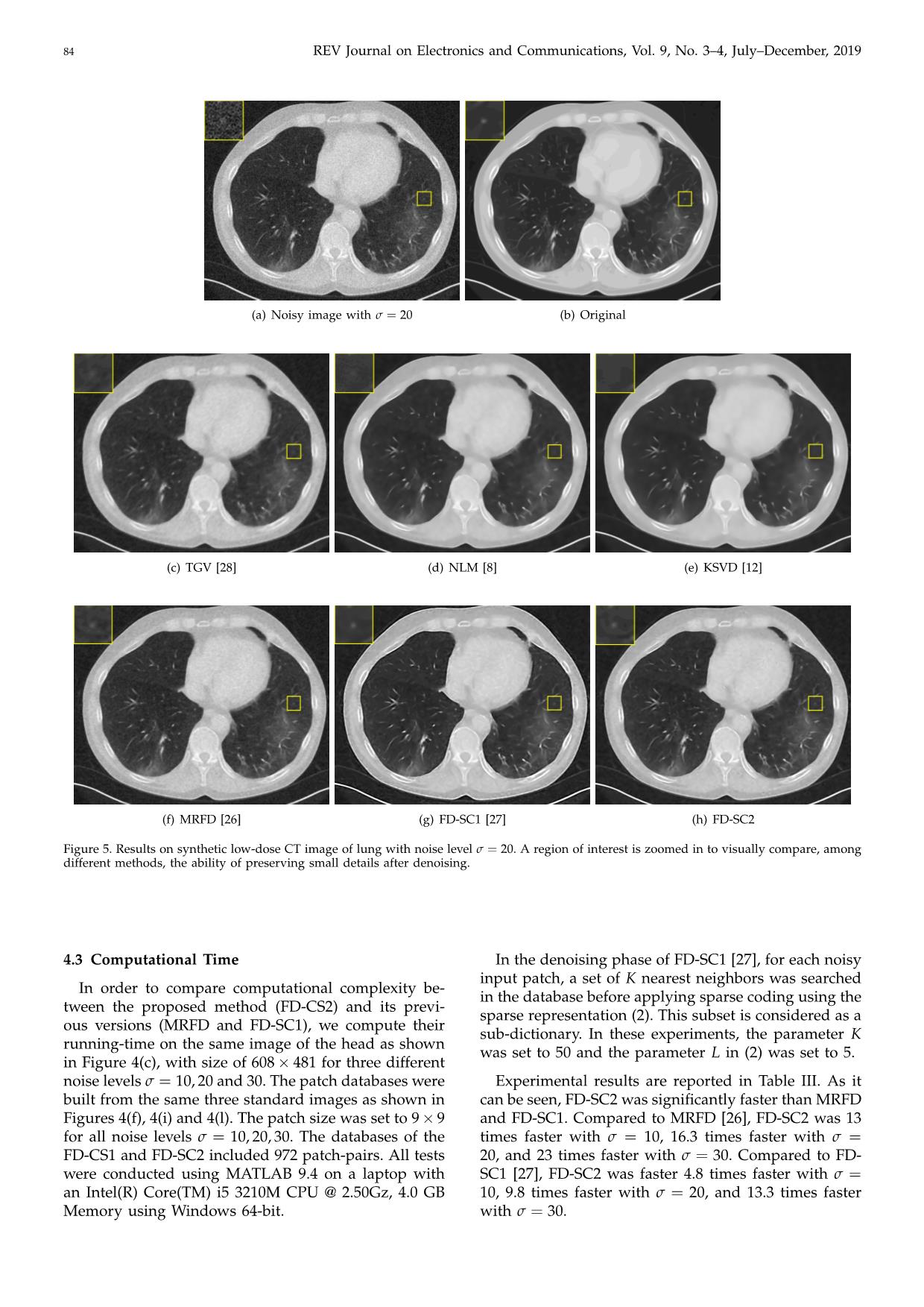Low-Dose CT image denoising using image decomposition and sparse representation trang 7