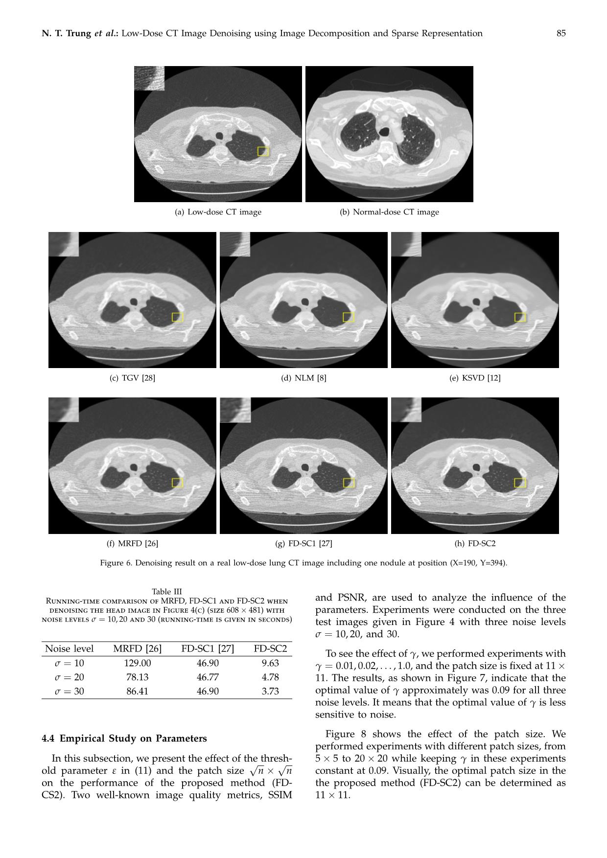 Low-Dose CT image denoising using image decomposition and sparse representation trang 8